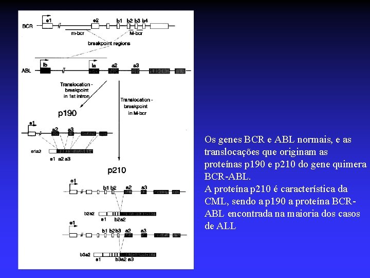 Bcr/abl Os genes BCR e ABL normais, e as translocações que originam as proteínas