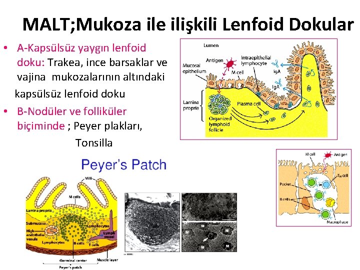 MALT; Mukoza ile ilişkili Lenfoid Dokular • A-Kapsülsüz yaygın lenfoid doku: Trakea, ince barsaklar