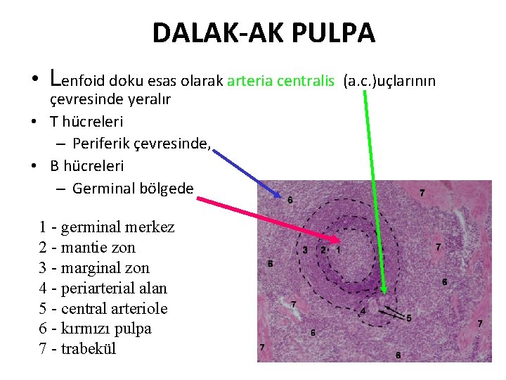 DALAK-AK PULPA • Lenfoid doku esas olarak arteria centralis (a. c. )uçlarının çevresinde yeralır