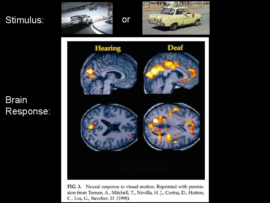 Stimulus: Brain Response: or 