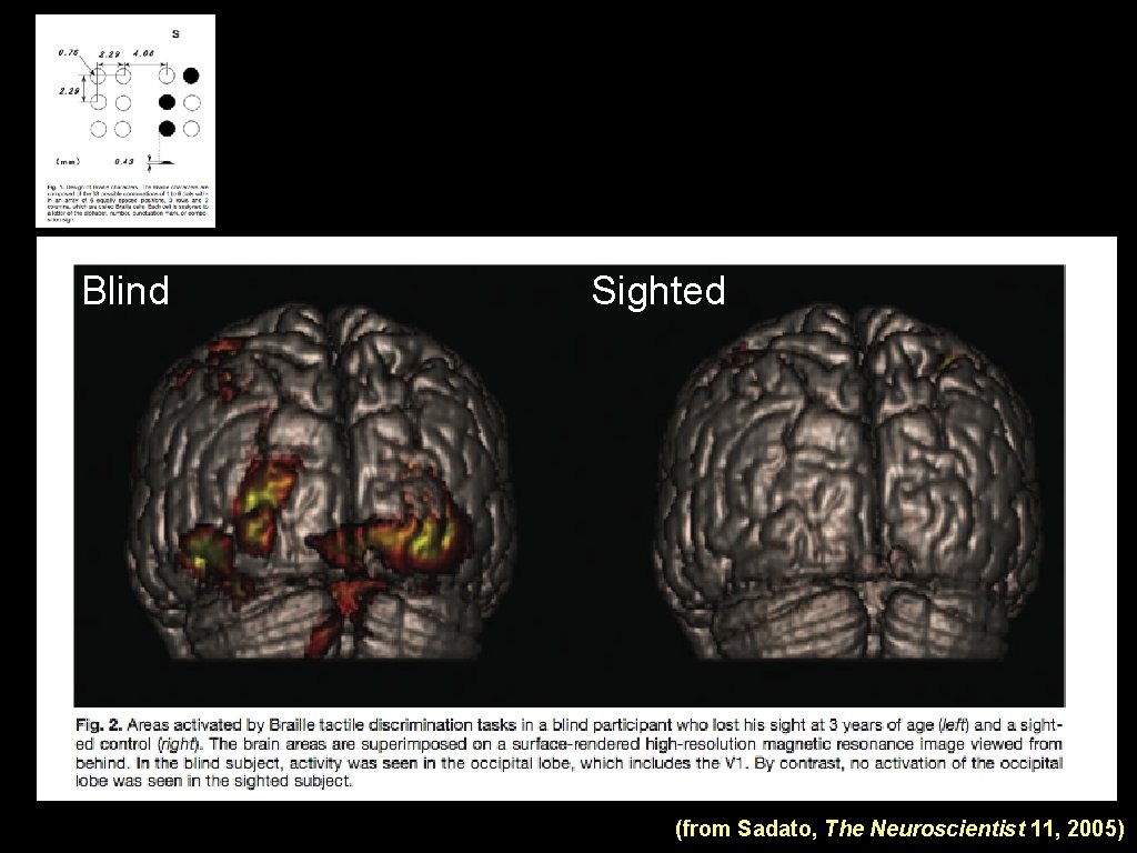 Blind Sighted (from Sadato, The Neuroscientist 11, 2005) 