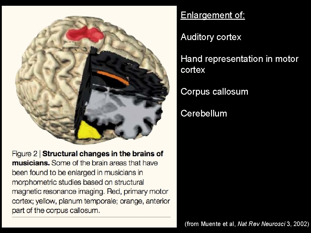 Enlargement of: Auditory cortex Hand representation in motor cortex Corpus callosum Cerebellum (from Muente