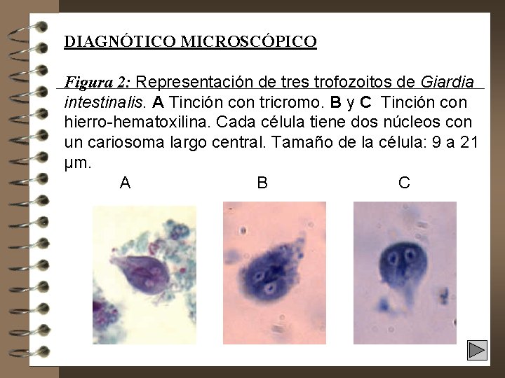 DIAGNÓTICO MICROSCÓPICO Figura 2: Representación de tres trofozoitos de Giardia intestinalis. A Tinción con