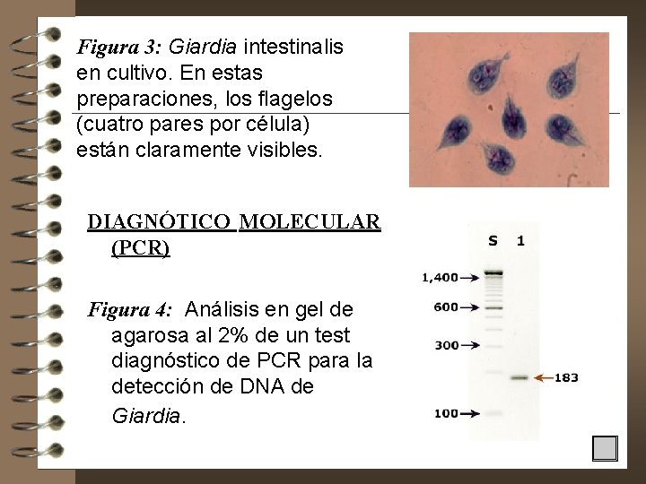 Figura 3: Giardia intestinalis en cultivo. En estas preparaciones, los flagelos (cuatro pares por