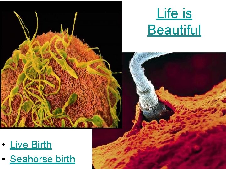 Life is Beautiful • Live Birth • Seahorse birth 