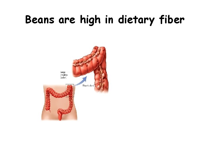 Beans are high in dietary fiber 