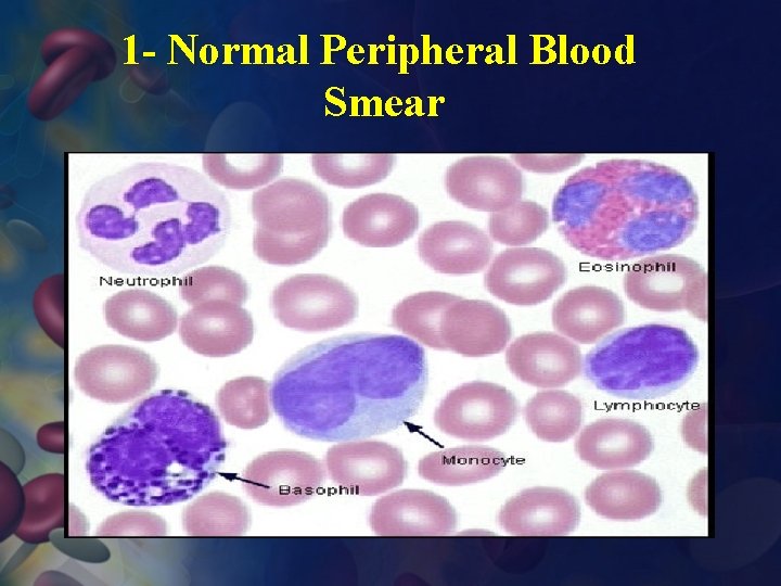  1 - Normal Peripheral Blood Smear 