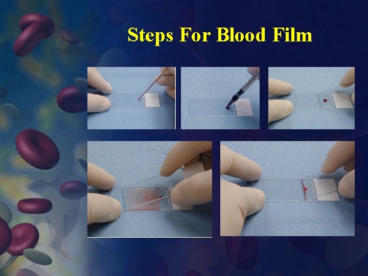 Steps For Blood Film 