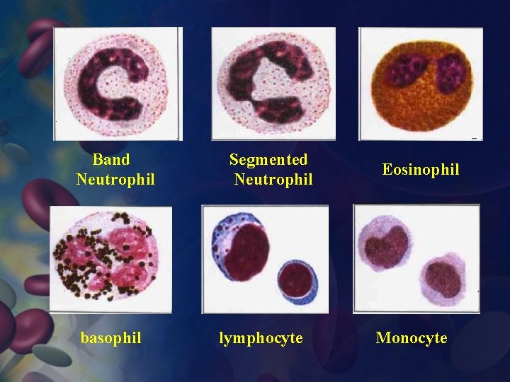 Band Neutrophil basophil Segmented Neutrophil lymphocyte Eosinophil Monocyte 
