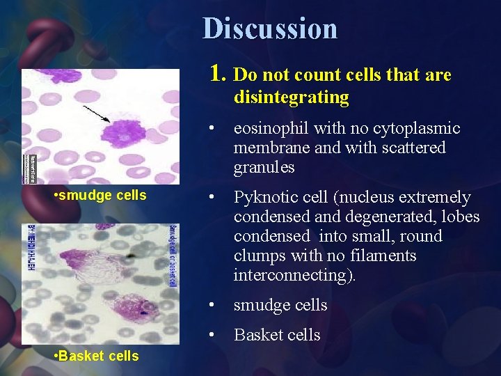 Discussion 1. Do not count cells that are disintegrating • eosinophil with no cytoplasmic