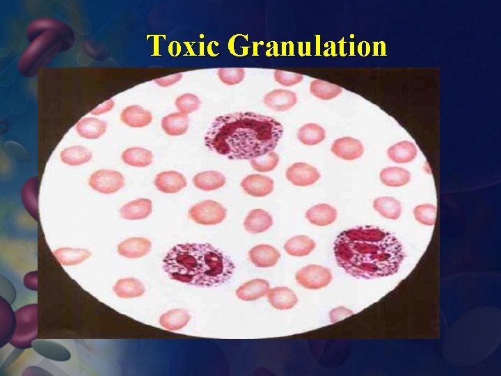  Toxic Granulation 