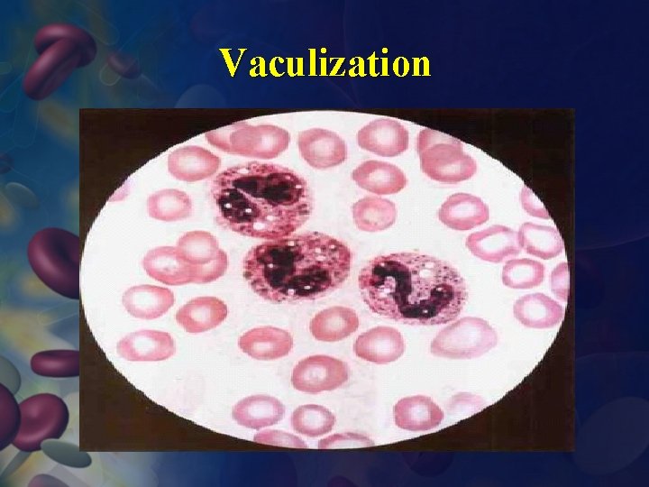 Vaculization 