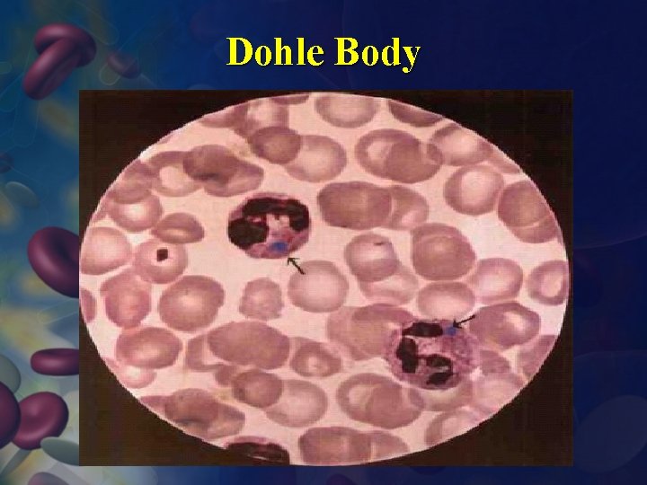 Dohle Body 