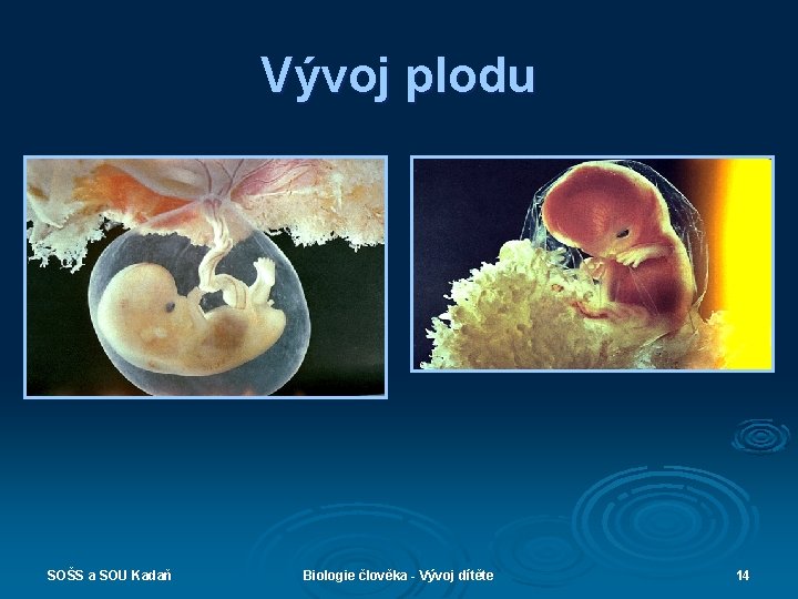 Vývoj plodu SOŠS a SOU Kadaň Biologie člověka - Vývoj dítěte 14 