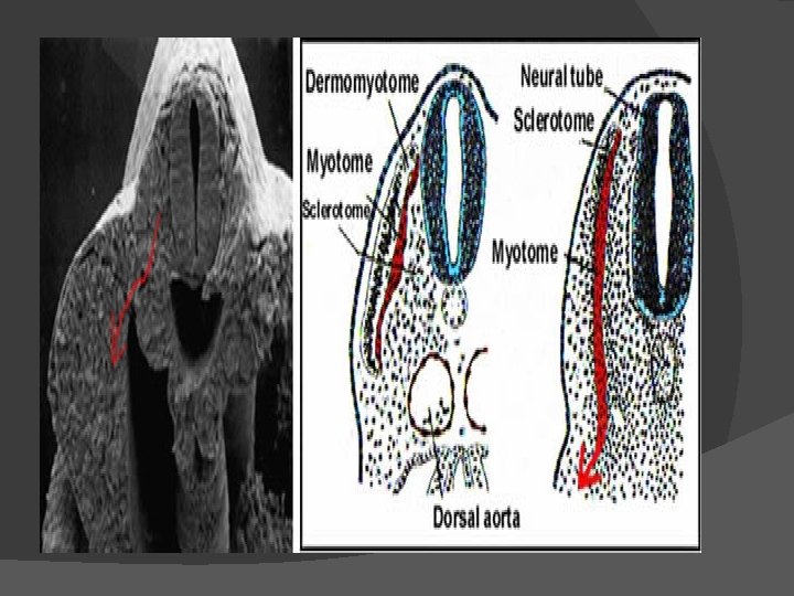 Figura 14. Embrión. En la derecha se esquematiza la imagen de la derecha. 