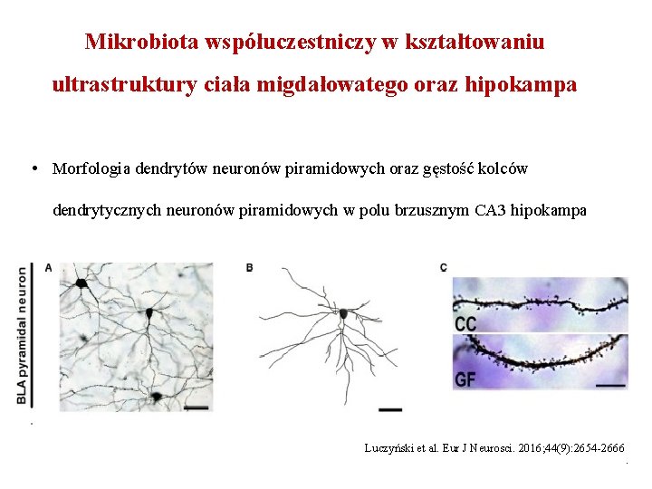 Mikrobiota współuczestniczy w kształtowaniu ultrastruktury ciała migdałowatego oraz hipokampa • Morfologia dendrytów neuronów piramidowych