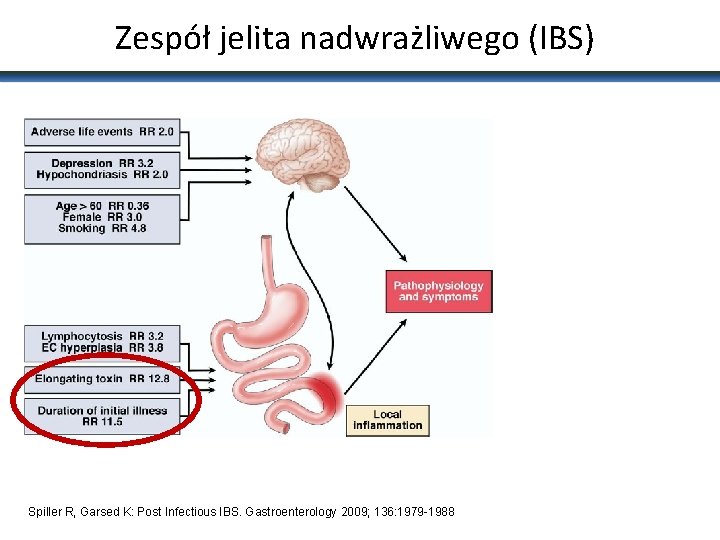 Zespół jelita nadwrażliwego (IBS) Spiller R, Garsed K: Post Infectious IBS. Gastroenterology 2009; 136: