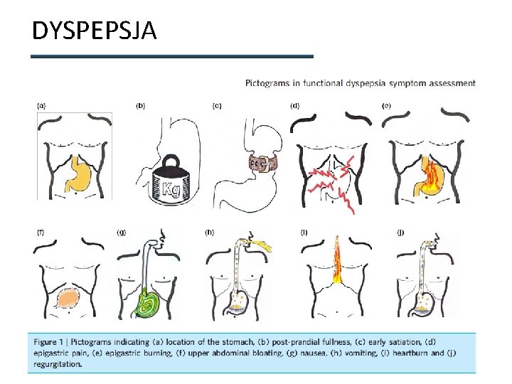 DYSPEPSJA 