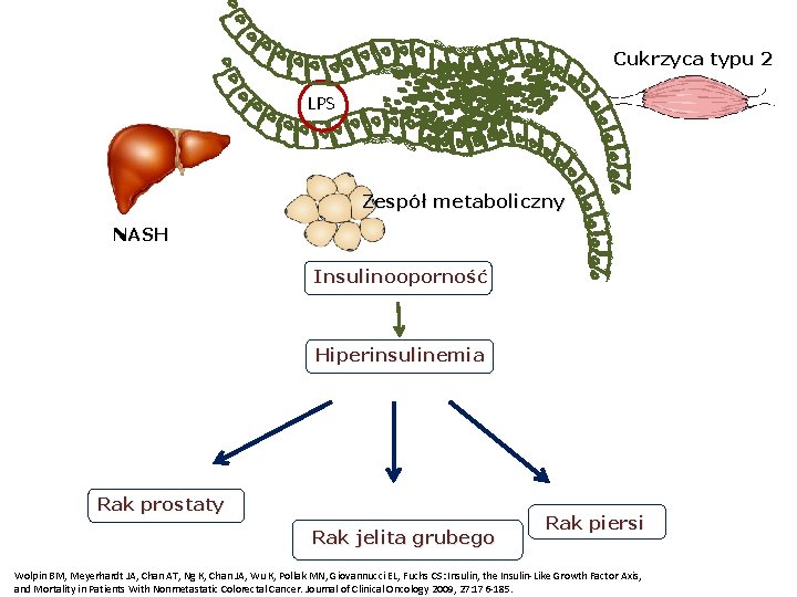 Cukrzyca typu 2 LPS Zespół metaboliczny NASH Insulinooporność Hiperinsulinemia Rak prostaty Rak jelita grubego