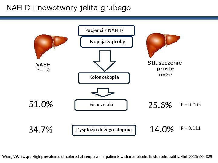 NAFLD i nowotwory jelita grubego Pacjenci z NAFLD Biopsja wątroby NASH n=49 Kolonoskopia 51.