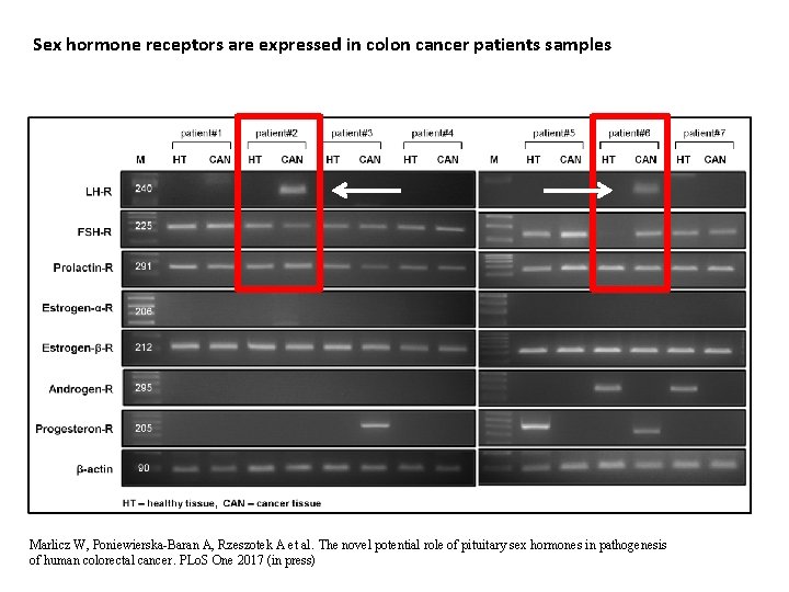 Sex hormone receptors are expressed in colon cancer patients samples Marlicz W, Poniewierska-Baran A,