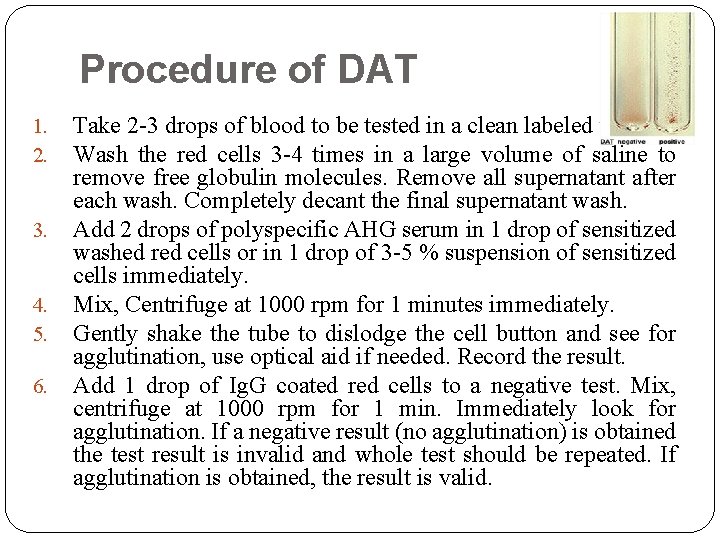 Procedure of DAT 1. 2. 3. 4. 5. 6. Take 2 -3 drops of