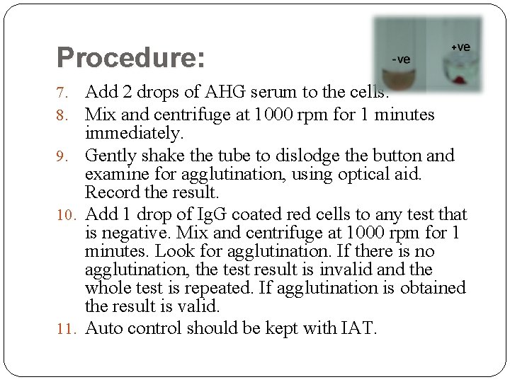 Procedure: 7. Add 2 drops of AHG serum to the cells. 8. Mix and