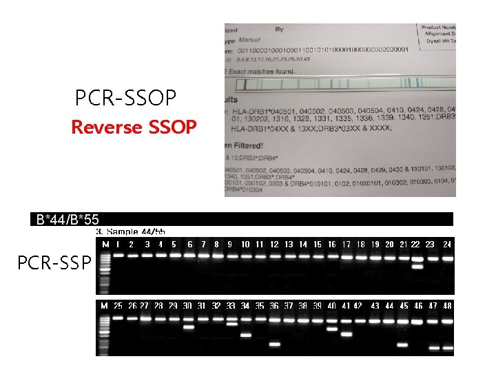 PCR-SSOP Reverse SSOP B*44/B*55 PCR-SSP 