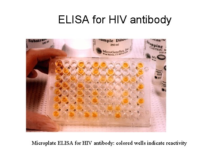 ELISA for HIV antibody Microplate ELISA for HIV antibody: colored wells indicate reactivity 