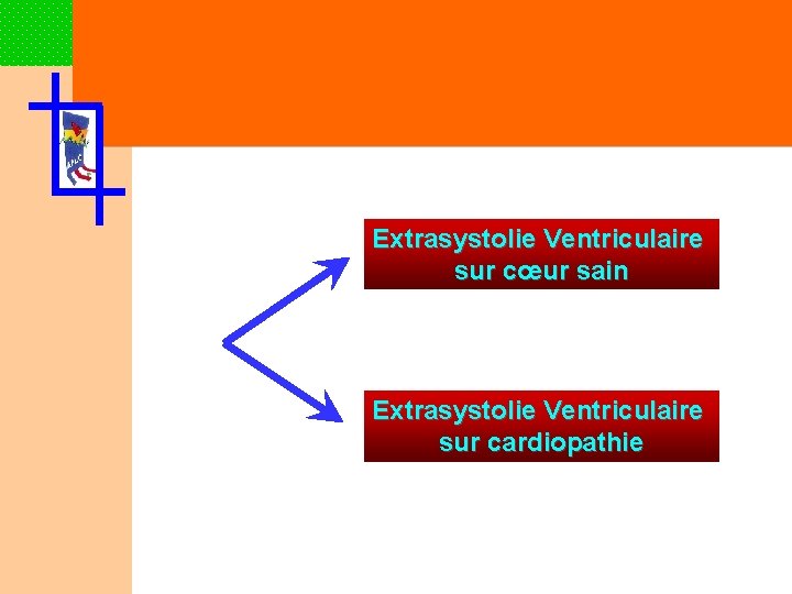 Extrasystolie Ventriculaire sur cœur sain Extrasystolie Ventriculaire sur cardiopathie 