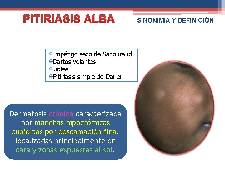 PITIRIASIS ALBA Impétigo seco de Sabouraud Dartos volantes Jiotes Pitiriasis simple de Darier Dermatosis