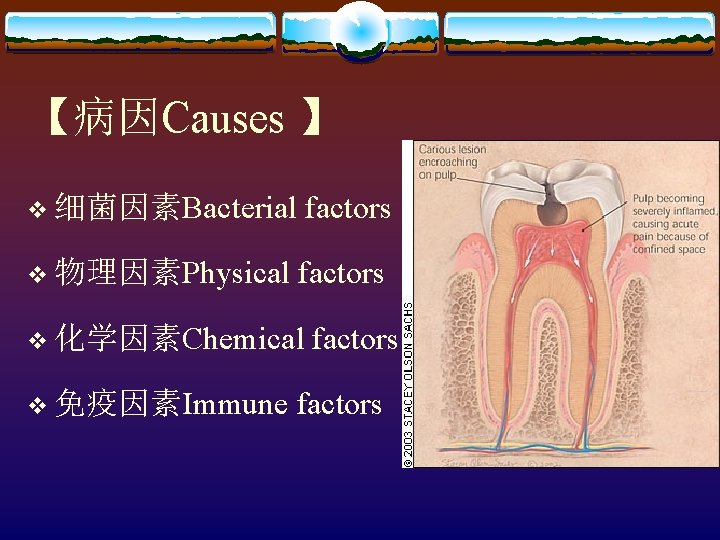  【病因Causes 】 v 细菌因素Bacterial factors v 物理因素Physical factors v 化学因素Chemical factors v 免疫因素Immune