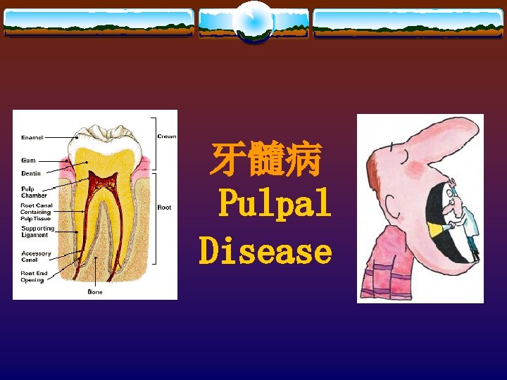 牙髓病 Pulpal Disease 