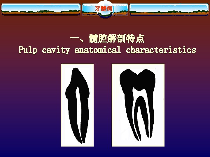 牙髓病 一、髓腔解剖特点 Pulp cavity anatomical characteristics 
