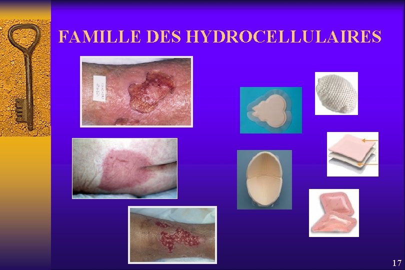 FAMILLE DES HYDROCELLULAIRES 17 