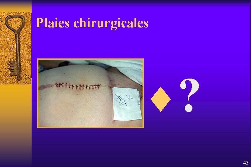 Plaies chirurgicales ¨? 43 