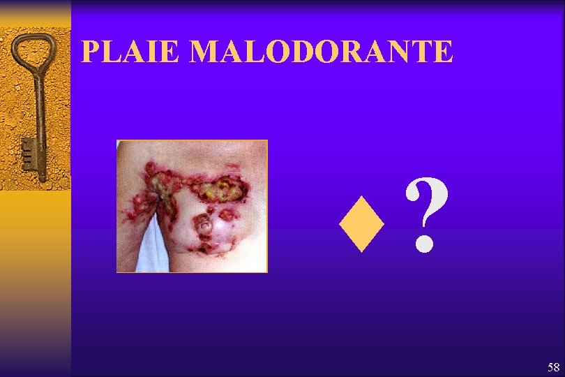 PLAIE MALODORANTE ¨? 58 