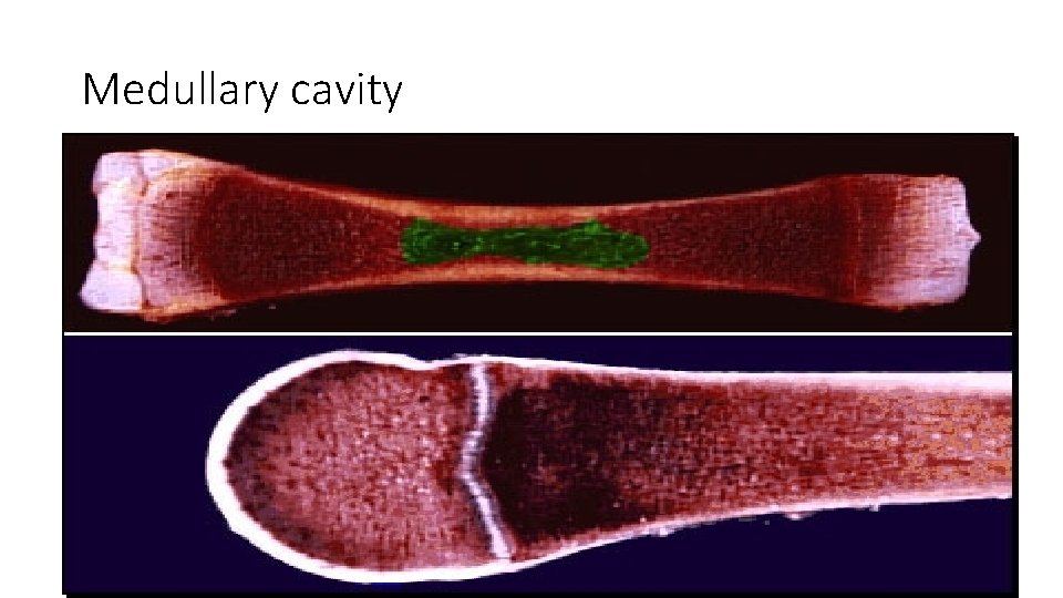 Medullary cavity Medullary cavity