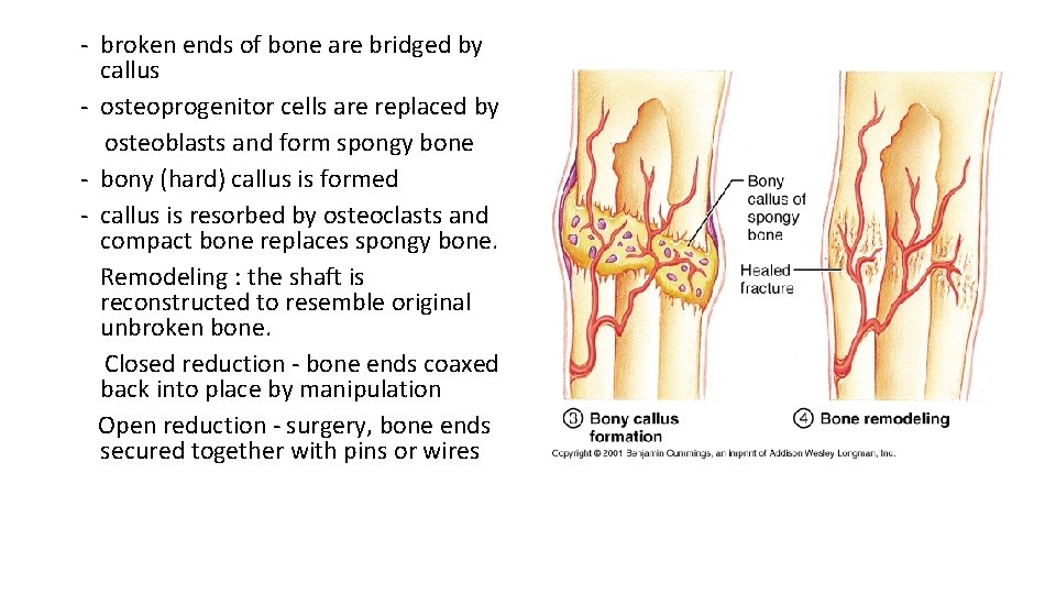 - broken ends of bone are bridged by callus - osteoprogenitor cells are replaced