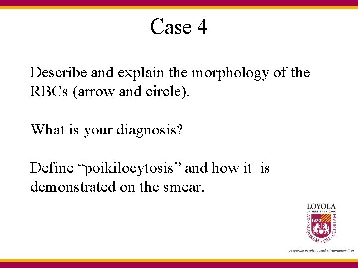 Case 4 Describe and explain the morphology of the RBCs (arrow and circle). What