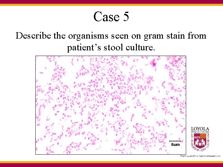 Case 5 Describe the organisms seen on gram stain from patient’s stool culture. 