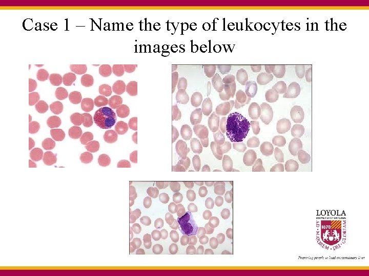 Case 1 – Name the type of leukocytes in the images below 