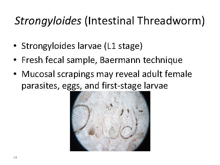 Strongyloides (Intestinal Threadworm) • Strongyloides larvae (L 1 stage) • Fresh fecal sample, Baermann