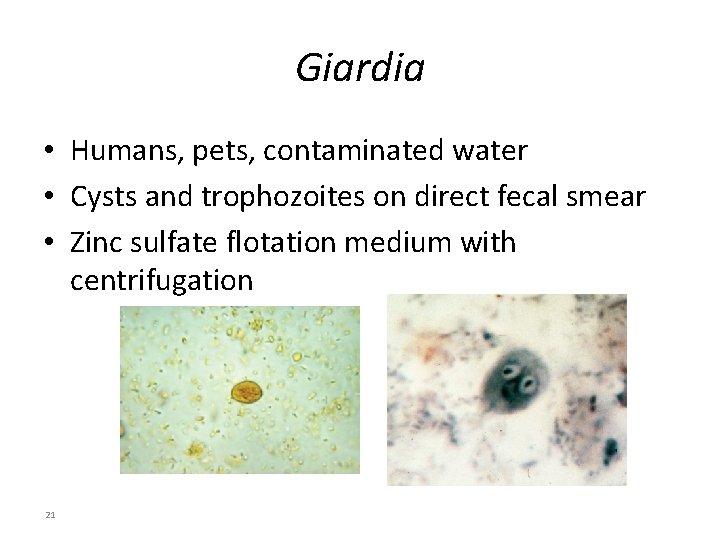 Giardia • Humans, pets, contaminated water • Cysts and trophozoites on direct fecal smear