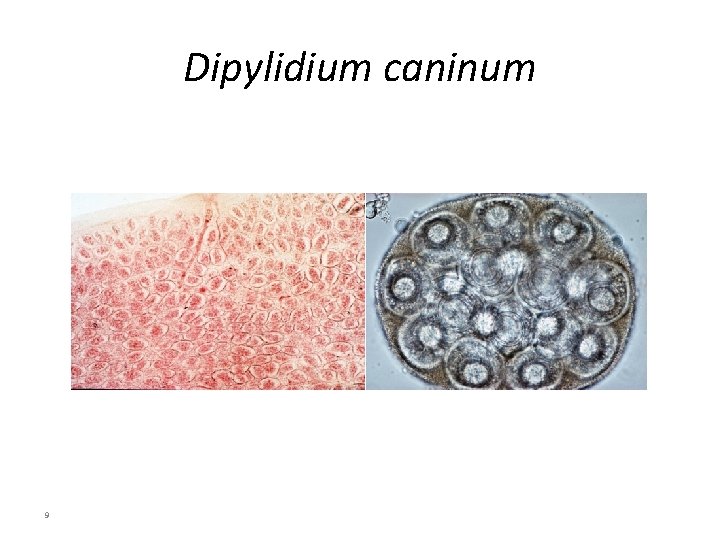 Dipylidium caninum 9 