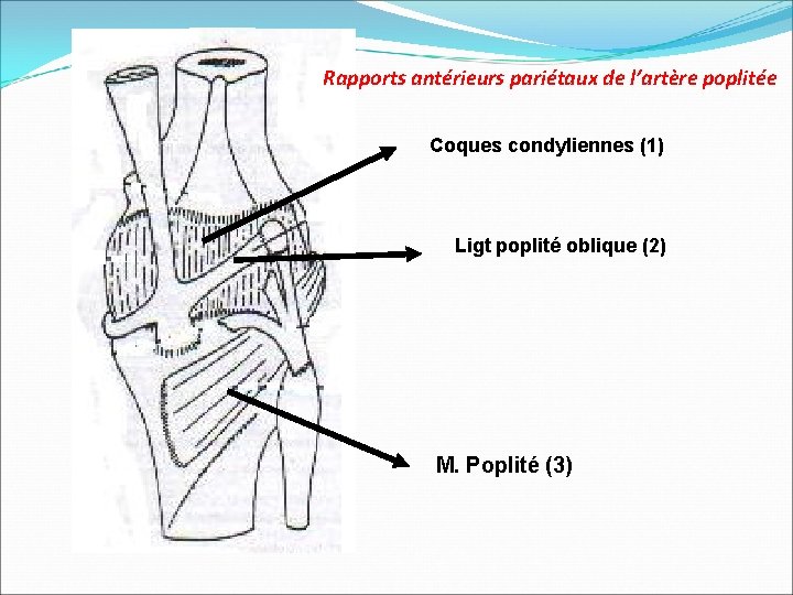 Rapports antérieurs pariétaux de l’artère poplitée Coques condyliennes (1) Ligt poplité oblique (2) M.