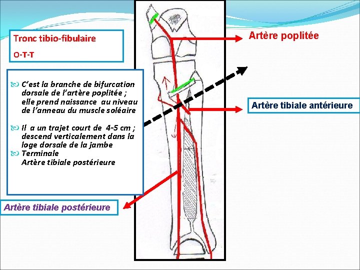 Tronc tibio-fibulaire Artère poplitée O-T-T C’est la branche de bifurcation dorsale de l’artère poplitée