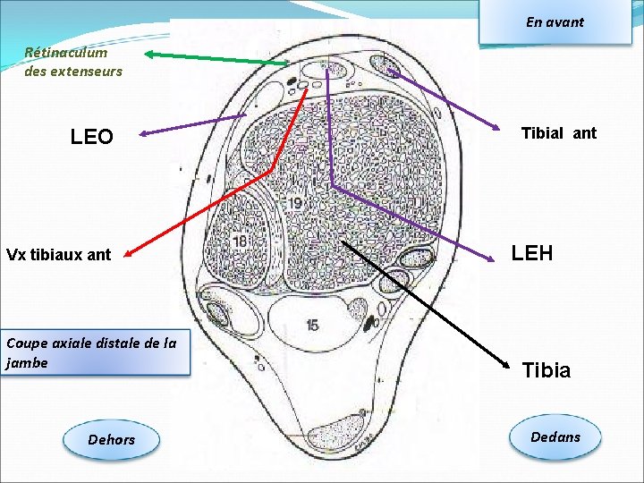 En avant Rétinaculum des extenseurs LEO Vx tibiaux ant Coupe axiale distale de la