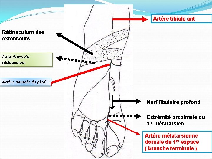 Artère tibiale ant Rétinaculum des extenseurs Bord distal du rétinaculum Artère dorsale du pied