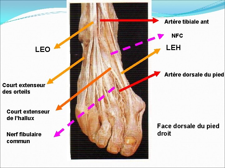 Artère tibiale ant NFC LEO LEH Artère dorsale du pied Court extenseur des orteils